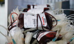 ۱۸ تا ۶۵ سال؛ سن اهدای خون/شرایط اهدای خون زنان و مردان